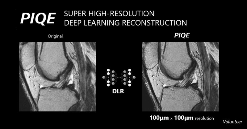 AIRS Medical's SwiftMR Wins Expanded FDA Clearance for Deep-Learning Reconstruction MRI